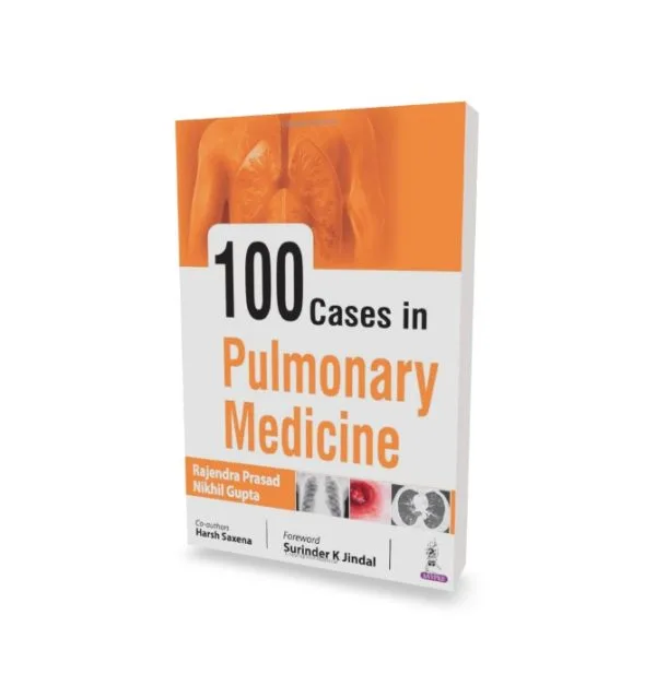 100 Cases in Pulmonary Medicine| Latest Edition